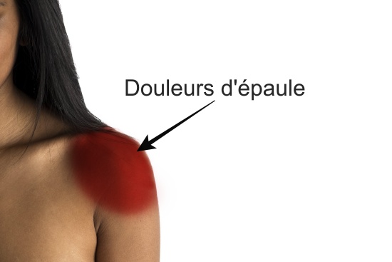 De plus en plus de gens ont des douleurs de l'épaule dû aux mouvements répétitifs. Assez rare mais cela peut entrainer l'arthrose de l'épaule et c'est très handicapant.