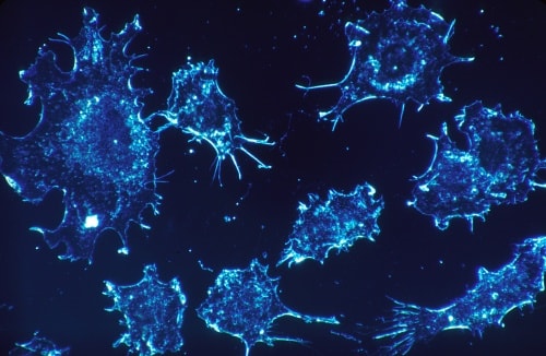 sante-redox.fr  Cellules-cancéreuses-