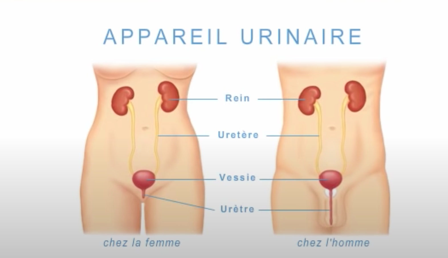 Les femmes sont plus exposées que les hommes au risque de contracter une infection urinaire.