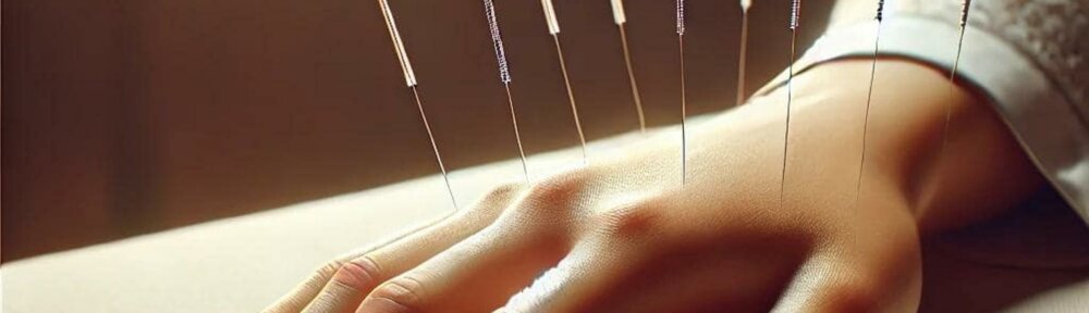 Main reposant sur une surface douce avec des aiguilles d'acupuncture insérées, symbolisant les bienfaits de l'acupuncture pour soulager les douleurs, réduire les tensions et améliorer l'équilibre énergétique.
